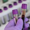 Plánovaný odber krvi v Rabči sa neuskutoční, spolok vyzýva aby ľudia darovali krv na ktoromkoľvek oddelení transfúznej služby
