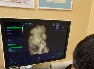 Ústredná vojenská nemocnica má nový 3D/4D ultrazvuk