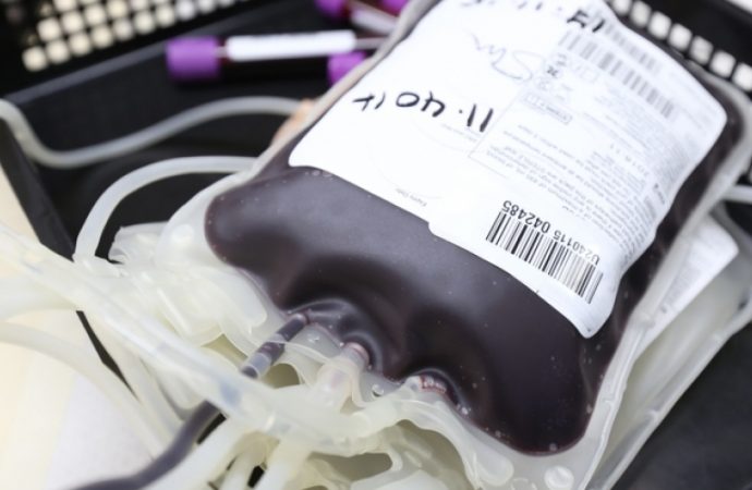 Univerzitná nemocnica Martin bojuje s nedostatkom krvi